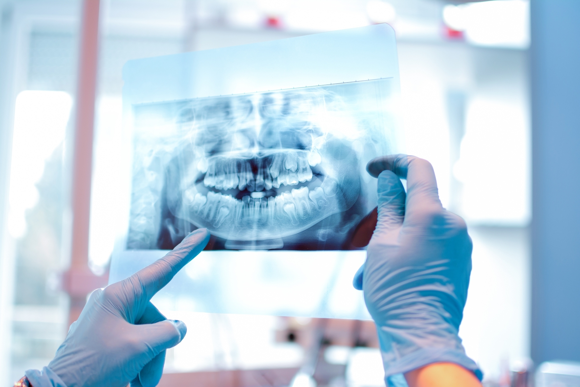 Oral-dental radiology images